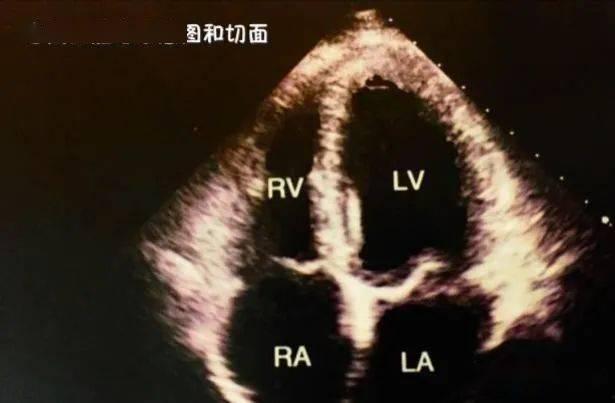 心脏彩超教学视频,深入解析心脏结构及功能