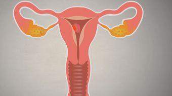 流月经视频,跟随视频揭秘女性生理周期